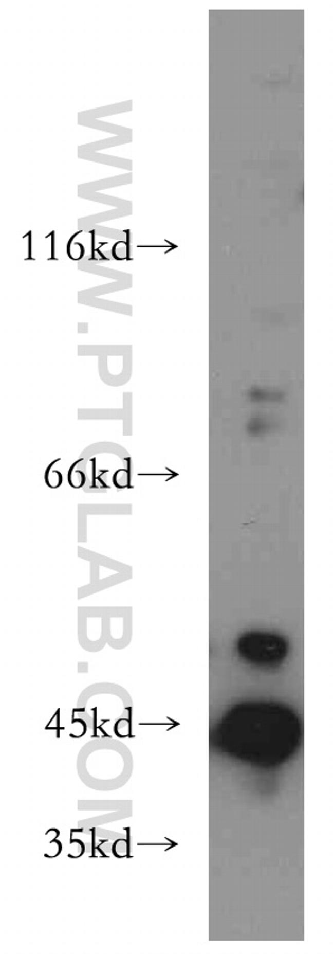 AGPAT9 Antibody in Western Blot (WB)