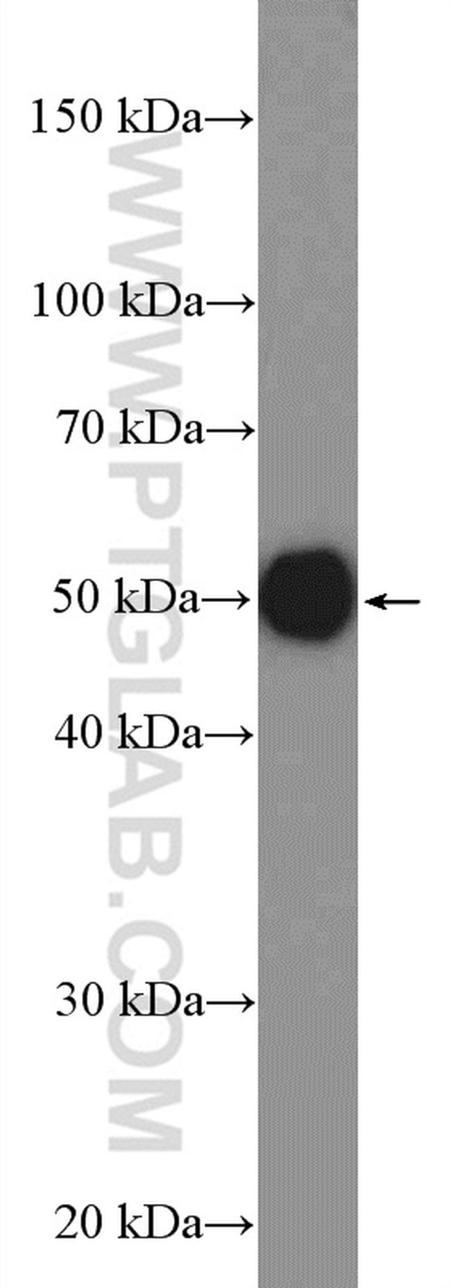 AGPAT9 Antibody in Western Blot (WB)