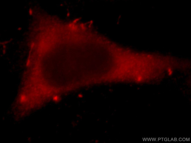 HECTD1 Antibody in Immunocytochemistry (ICC/IF)