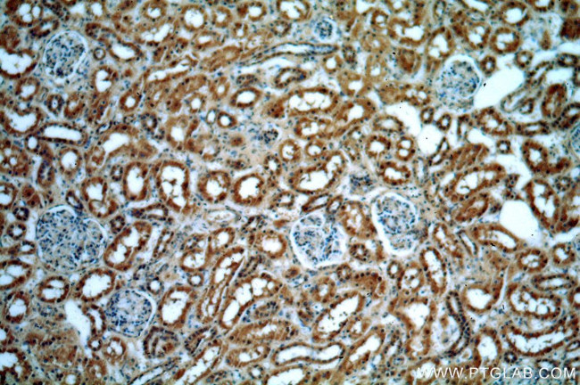 HECTD1 Antibody in Immunohistochemistry (Paraffin) (IHC (P))