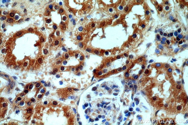 HECTD1 Antibody in Immunohistochemistry (Paraffin) (IHC (P))