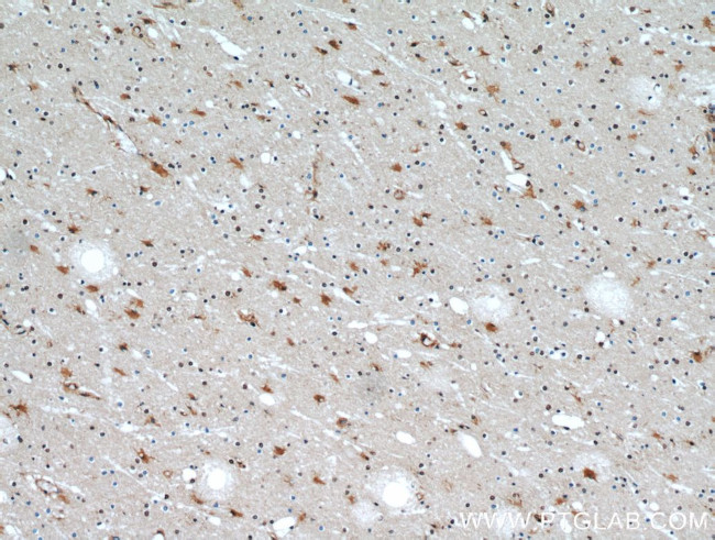 HECTD1 Antibody in Immunohistochemistry (Paraffin) (IHC (P))