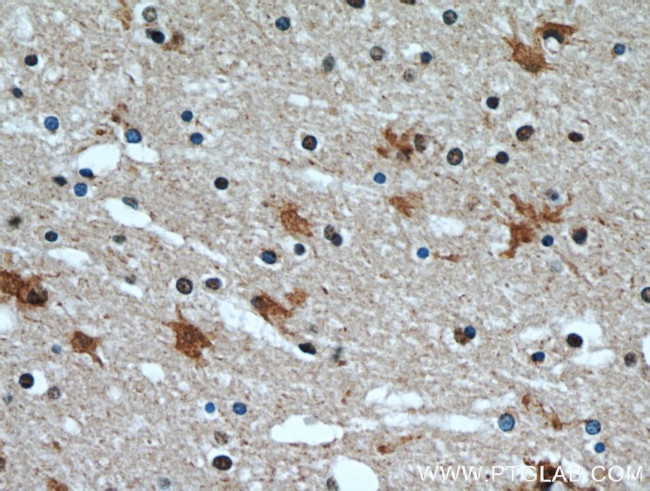 HECTD1 Antibody in Immunohistochemistry (Paraffin) (IHC (P))