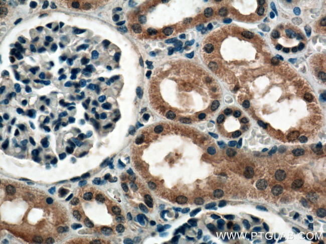 HECTD1 Antibody in Immunohistochemistry (Paraffin) (IHC (P))