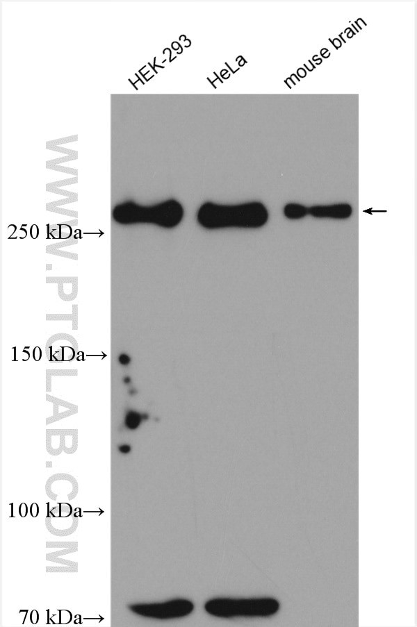 HECTD1 Antibody in Western Blot (WB)