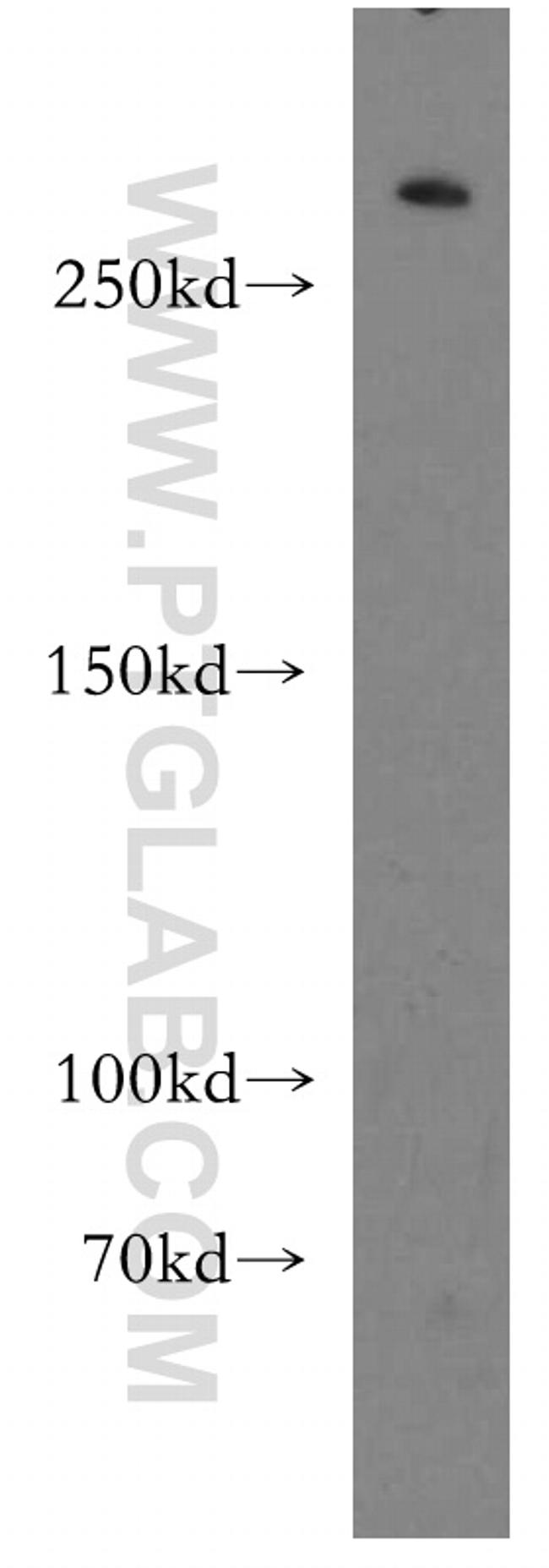 HECTD1 Antibody in Western Blot (WB)