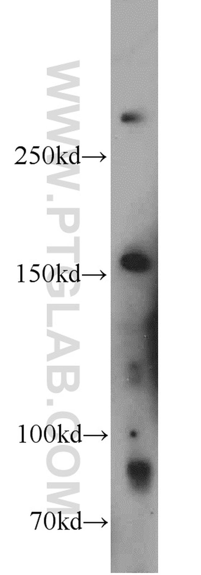 HECTD1 Antibody in Western Blot (WB)