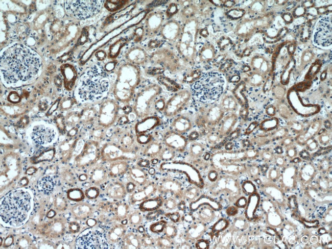 SLC37A4 Antibody in Immunohistochemistry (Paraffin) (IHC (P))