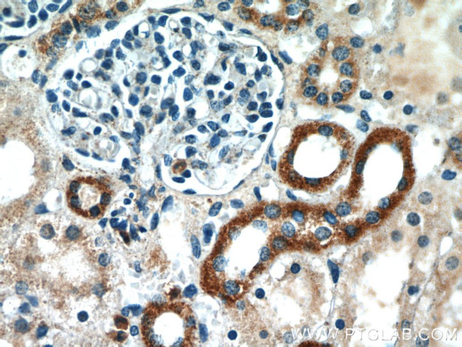 SLC37A4 Antibody in Immunohistochemistry (Paraffin) (IHC (P))