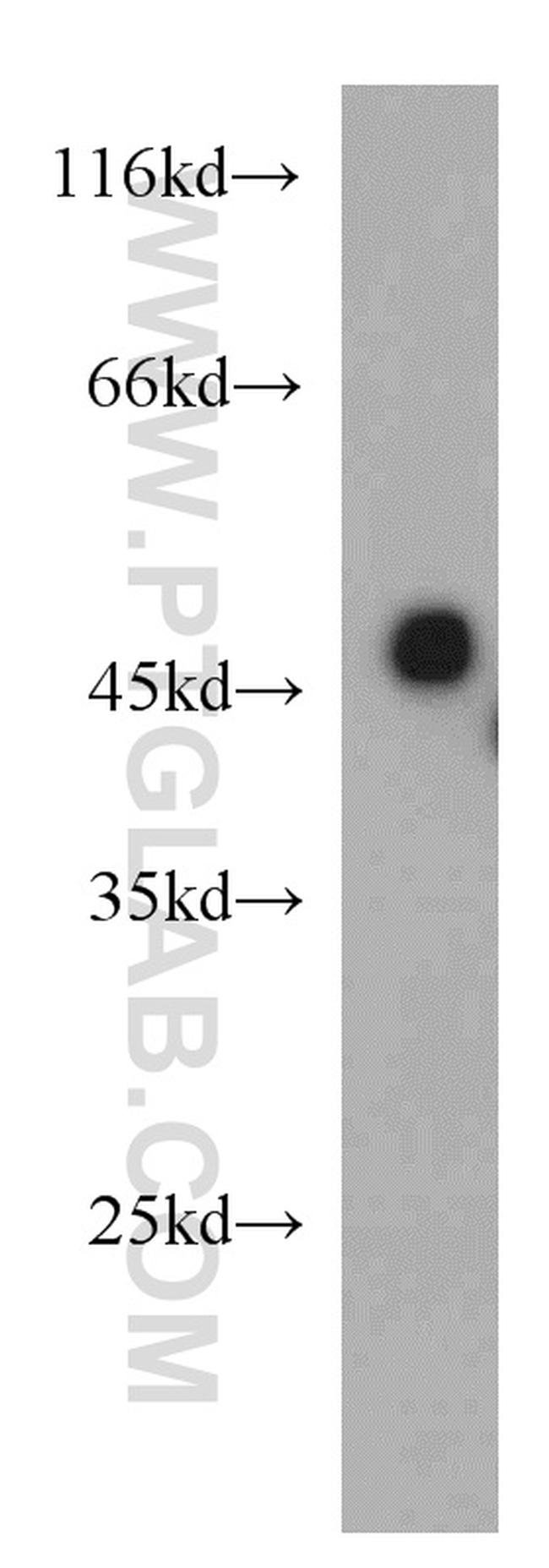 SLC37A4 Antibody in Western Blot (WB)