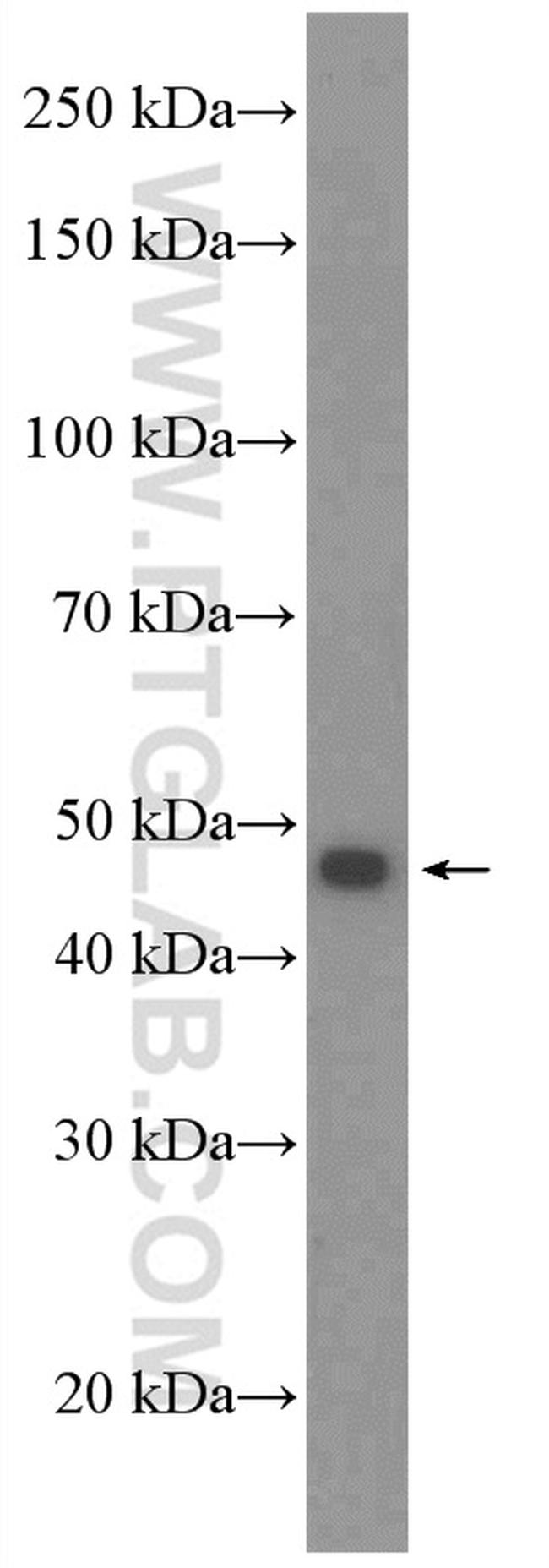 SLC37A4 Antibody in Western Blot (WB)