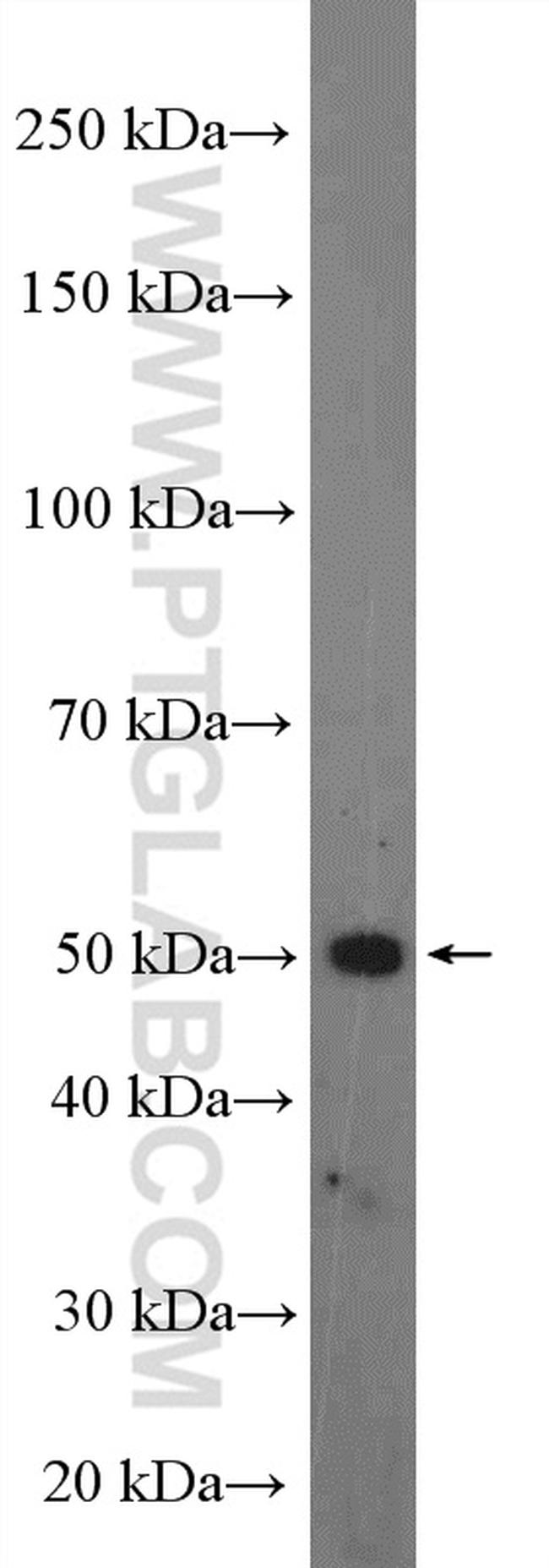 SLC37A4 Antibody in Western Blot (WB)