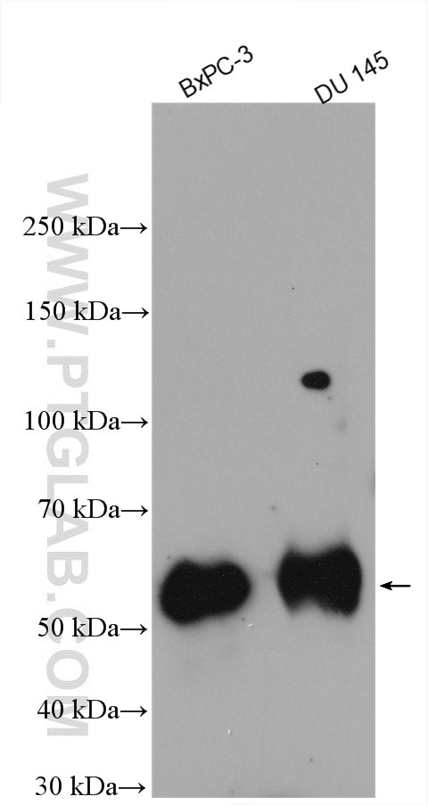 FAM83A Antibody in Western Blot (WB)