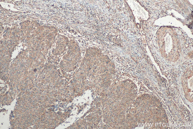 STC1 Antibody in Immunohistochemistry (Paraffin) (IHC (P))