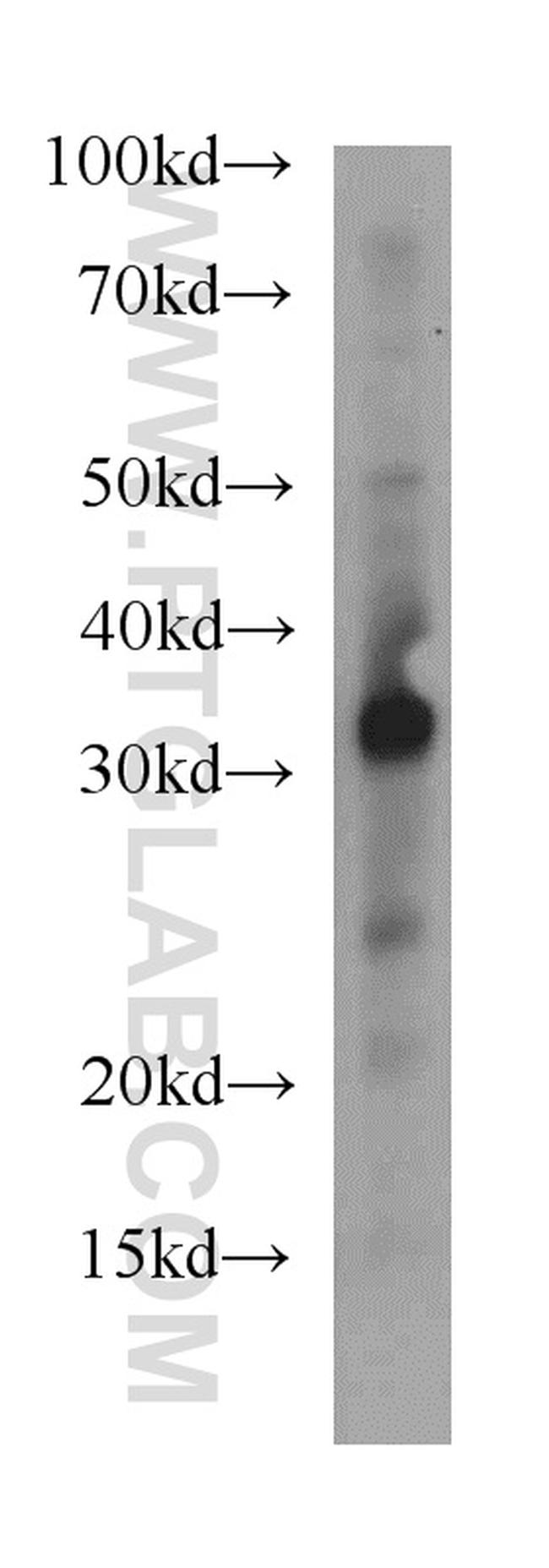 STC1 Antibody in Western Blot (WB)