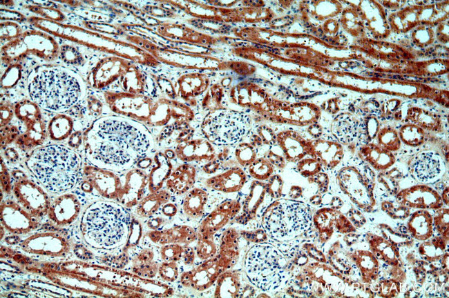 ABHD12B Antibody in Immunohistochemistry (Paraffin) (IHC (P))