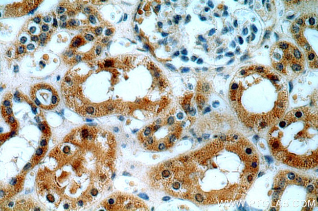 ABHD12B Antibody in Immunohistochemistry (Paraffin) (IHC (P))