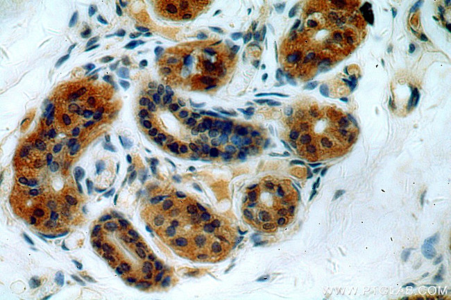 ABHD12B Antibody in Immunohistochemistry (Paraffin) (IHC (P))