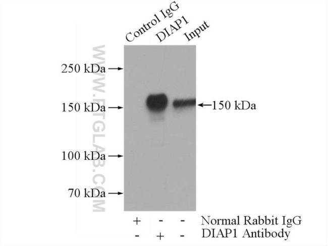 mDia1 Antibody in Immunoprecipitation (IP)