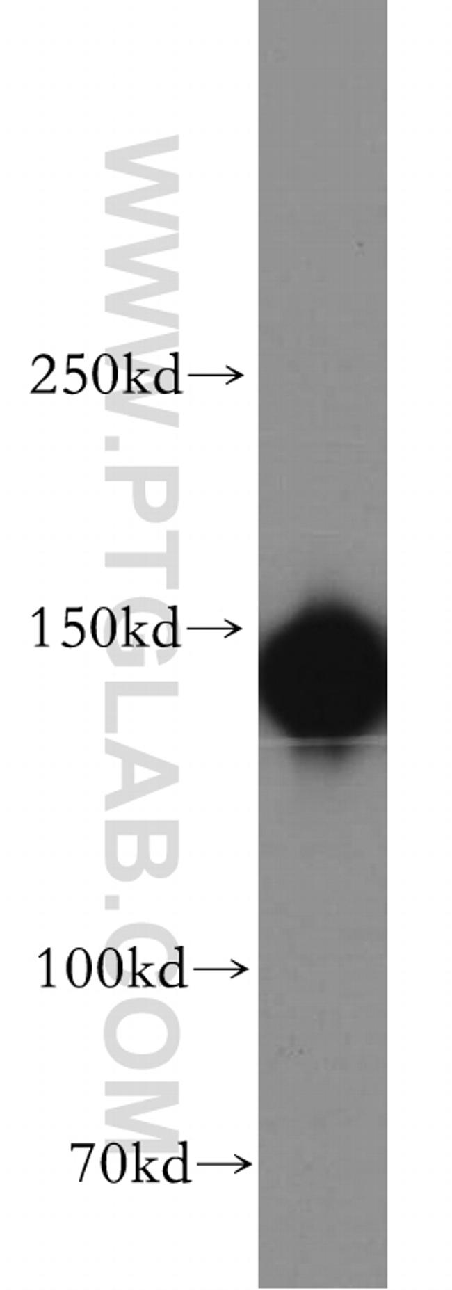 mDia1 Antibody in Western Blot (WB)