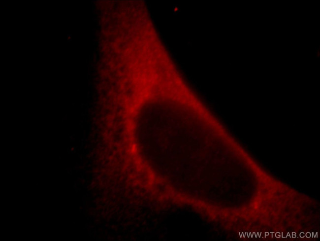 mDia1 Antibody in Immunocytochemistry (ICC/IF)