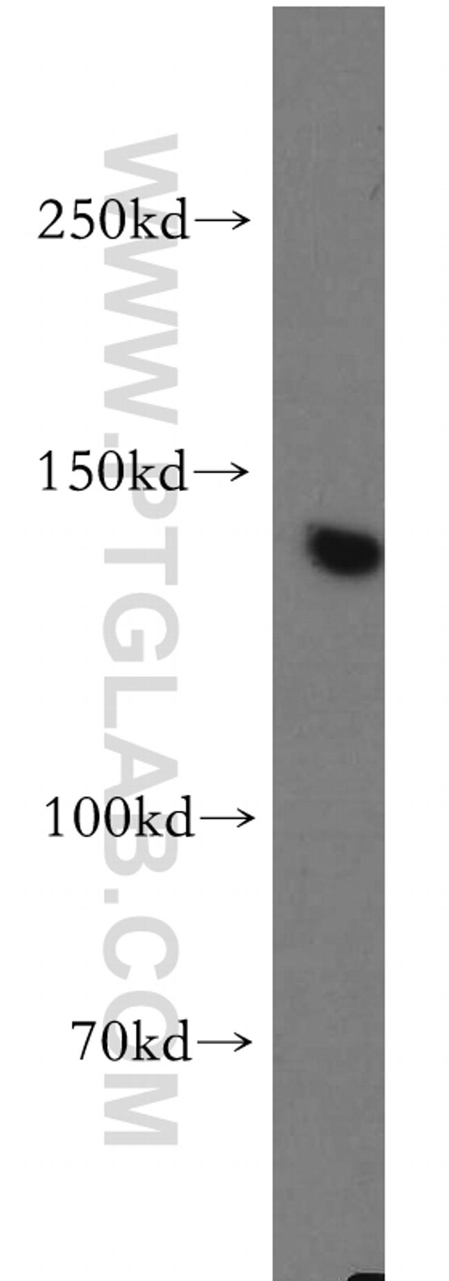 mDia1 Antibody in Western Blot (WB)