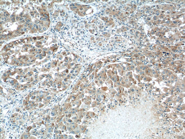 ZIP4 Antibody in Immunohistochemistry (Paraffin) (IHC (P))