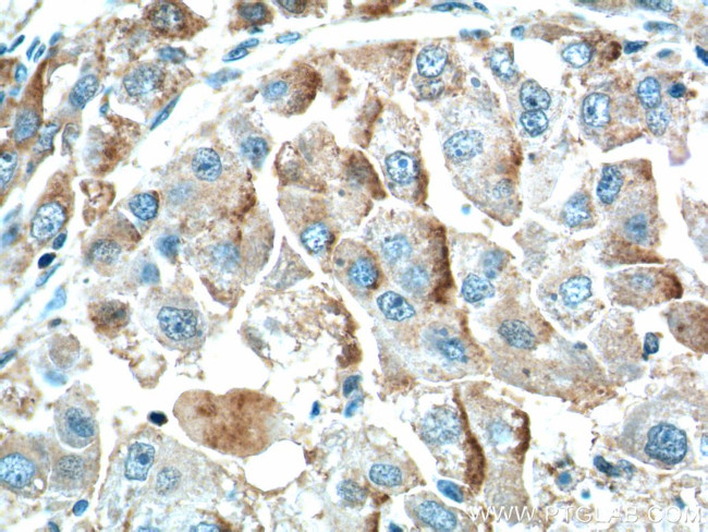 ZIP4 Antibody in Immunohistochemistry (Paraffin) (IHC (P))