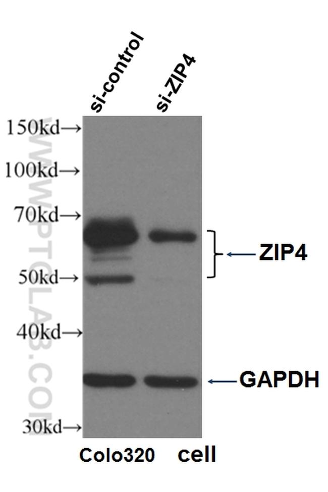 ZIP4 Antibody in Western Blot (WB)