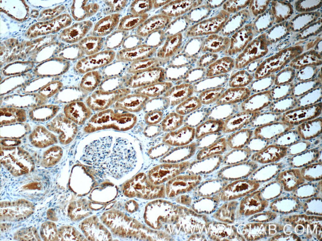 ZIP4 Antibody in Immunohistochemistry (Paraffin) (IHC (P))