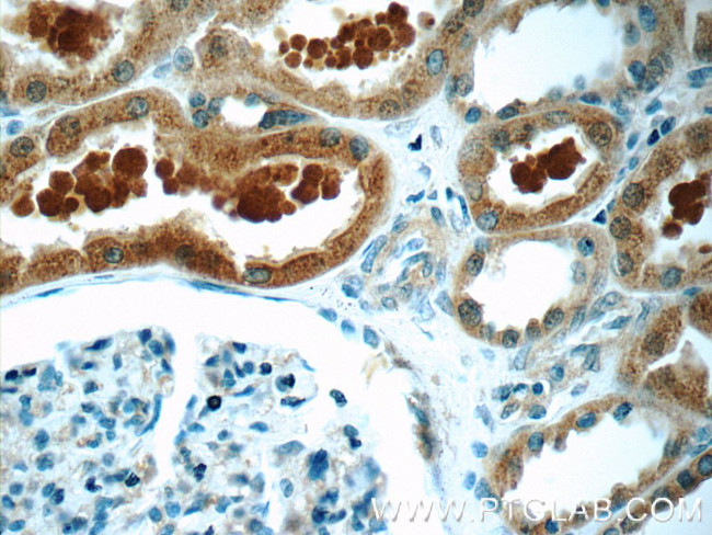 ZIP4 Antibody in Immunohistochemistry (Paraffin) (IHC (P))