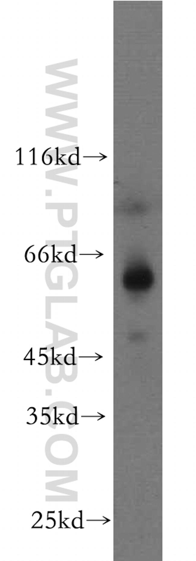 ZIP4 Antibody in Western Blot (WB)