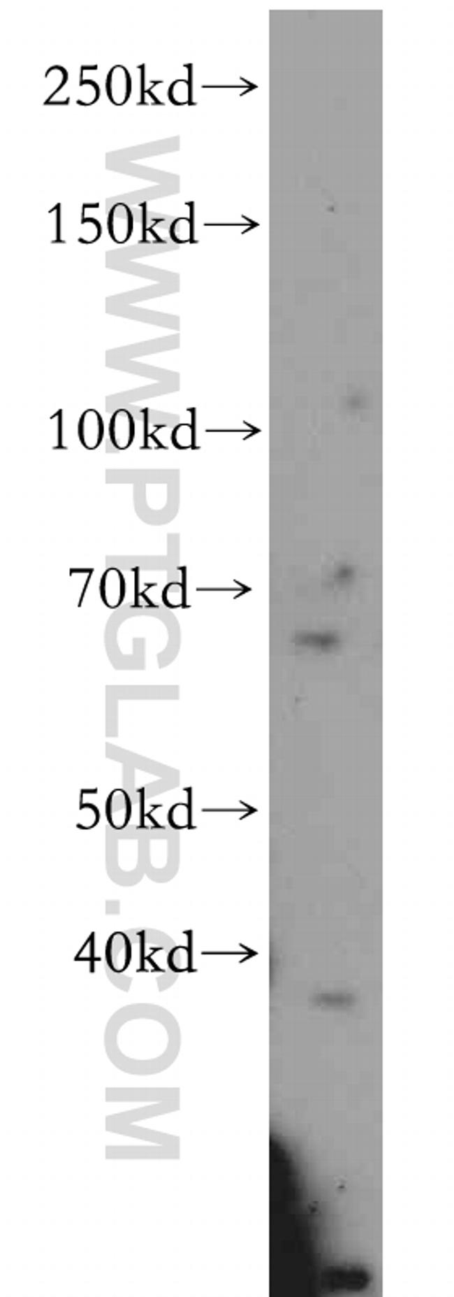 SLC22A15 Antibody in Western Blot (WB)