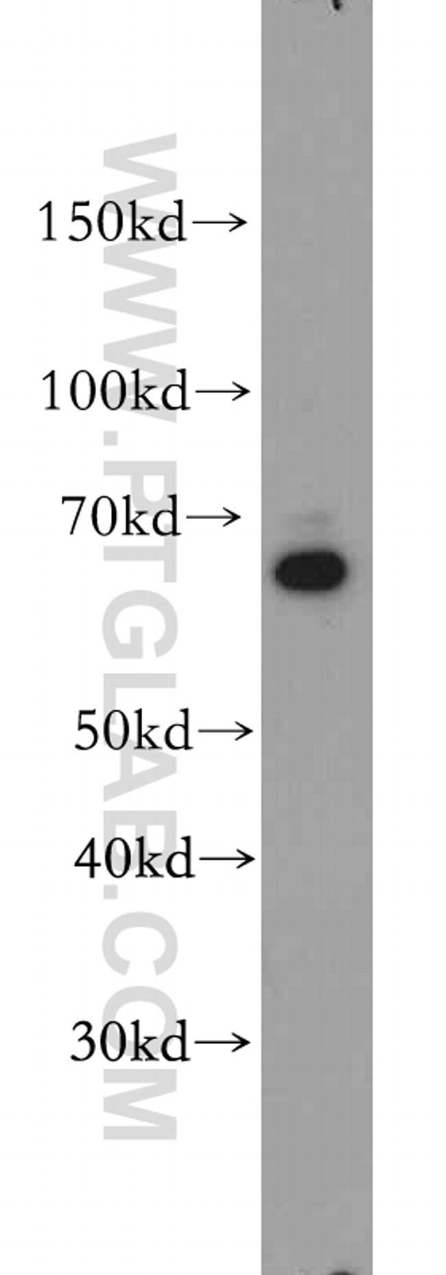 SLC22A15 Antibody in Western Blot (WB)