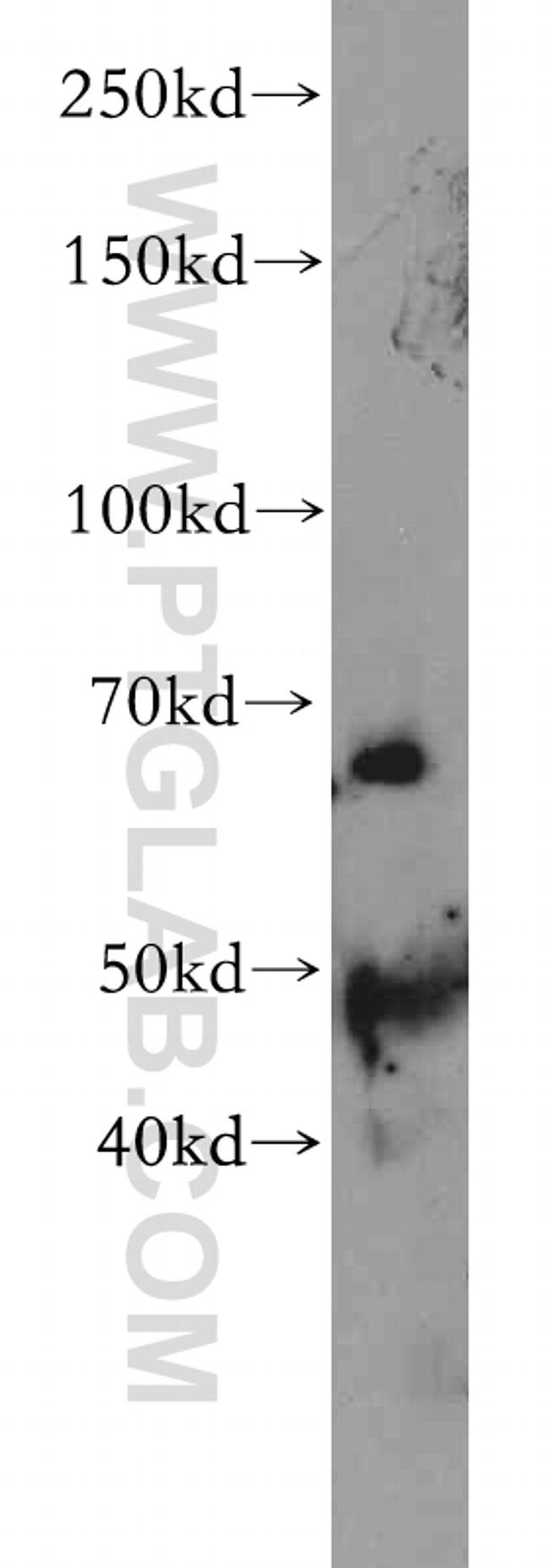 SLC22A15 Antibody in Western Blot (WB)