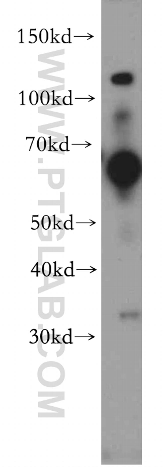 SLC22A15 Antibody in Western Blot (WB)