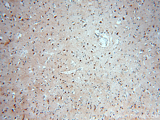 SOX8 Antibody in Immunohistochemistry (Paraffin) (IHC (P))