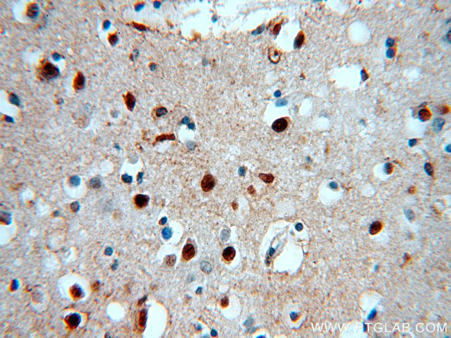 SOX8 Antibody in Immunohistochemistry (Paraffin) (IHC (P))