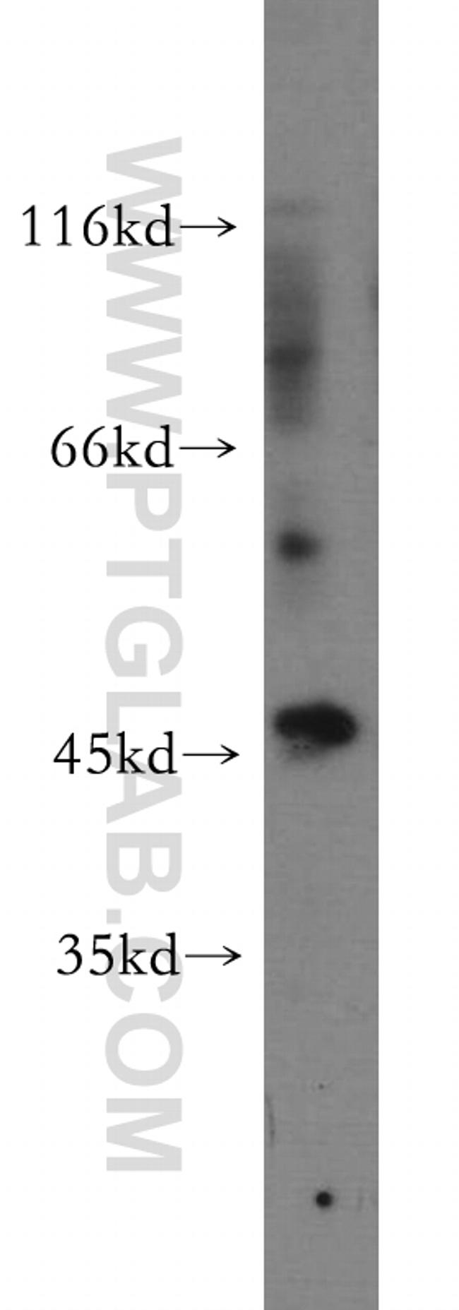 SOX8 Antibody in Western Blot (WB)