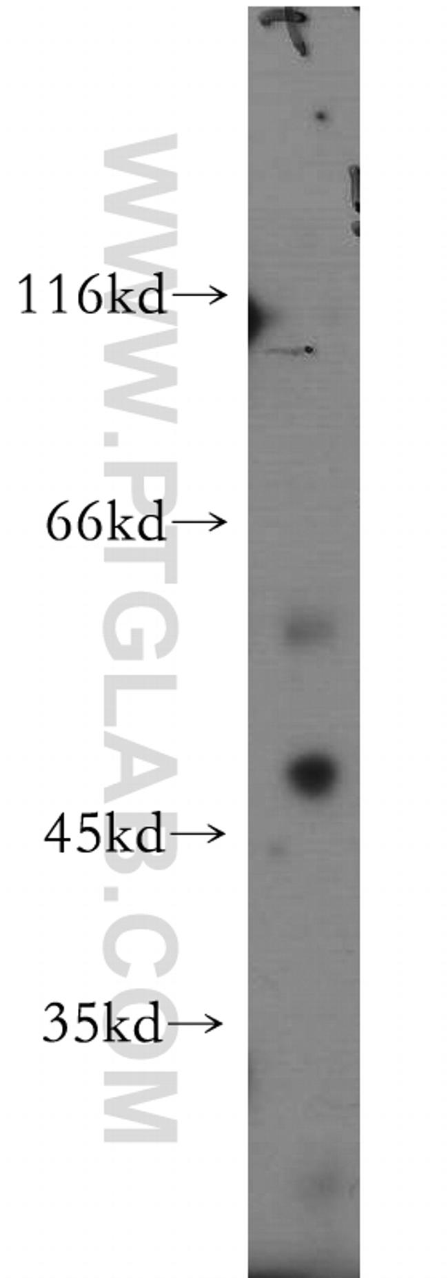 SOX8 Antibody in Western Blot (WB)