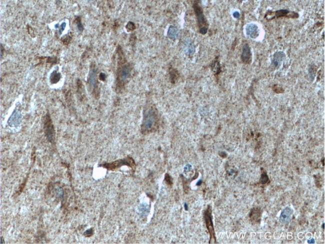 IIP45 Antibody in Immunohistochemistry (Paraffin) (IHC (P))