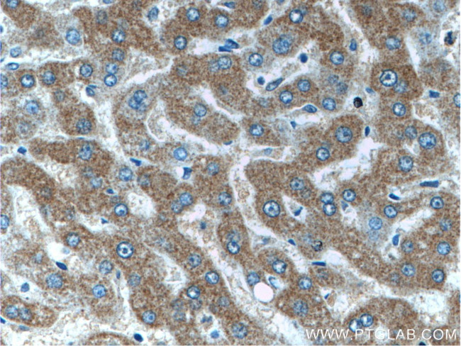 IIP45 Antibody in Immunohistochemistry (Paraffin) (IHC (P))