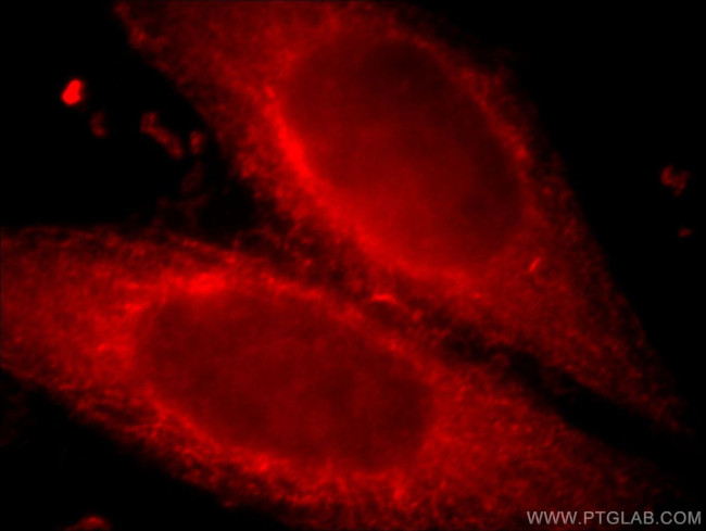 CXCR2 Antibody in Immunocytochemistry (ICC/IF)