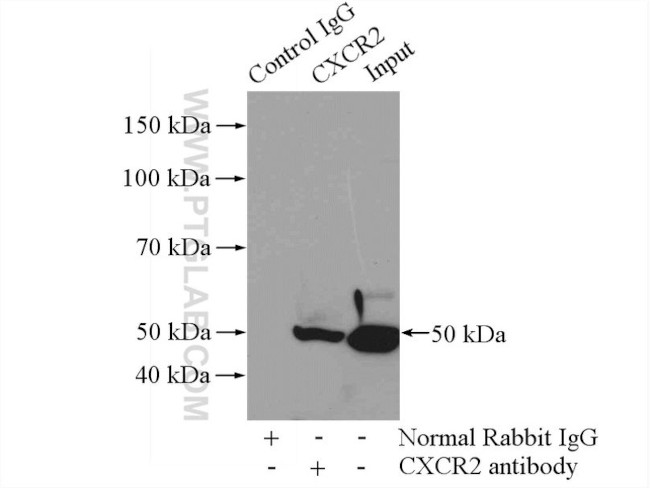 CXCR2 Antibody in Immunoprecipitation (IP)