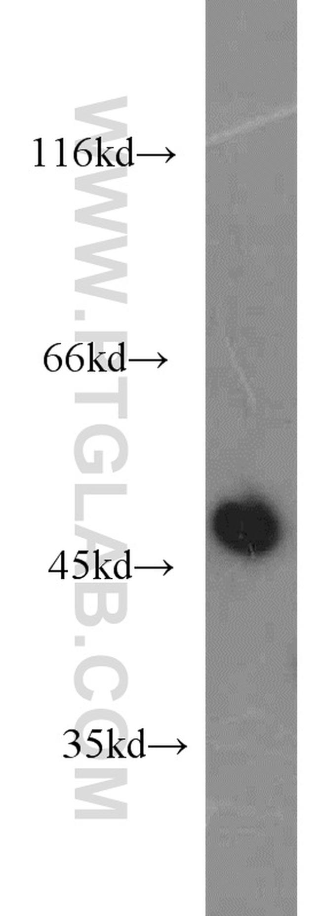 CXCR2 Antibody in Western Blot (WB)