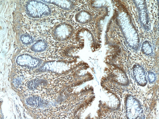 CXCR2 Antibody in Immunohistochemistry (Paraffin) (IHC (P))