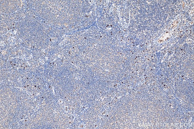 CXCR2 Antibody in Immunohistochemistry (Paraffin) (IHC (P))