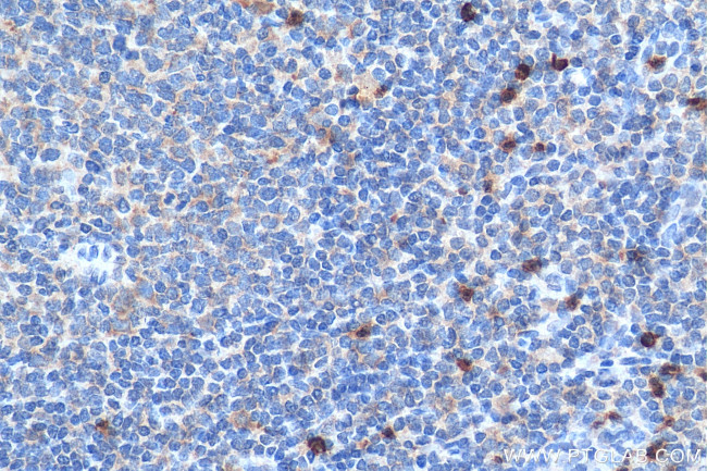 CXCR2 Antibody in Immunohistochemistry (Paraffin) (IHC (P))