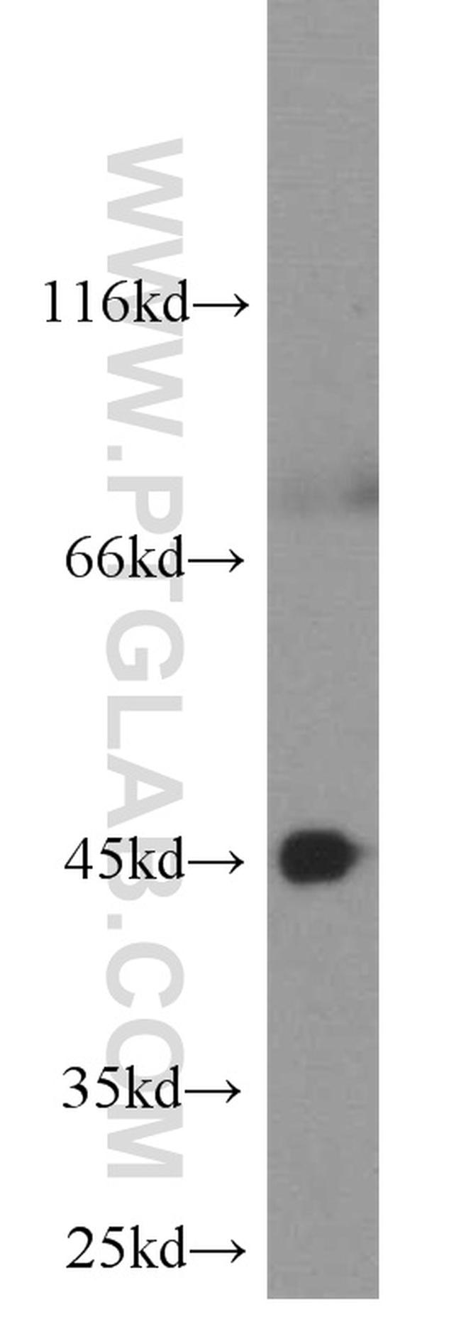 CXCR2 Antibody in Western Blot (WB)