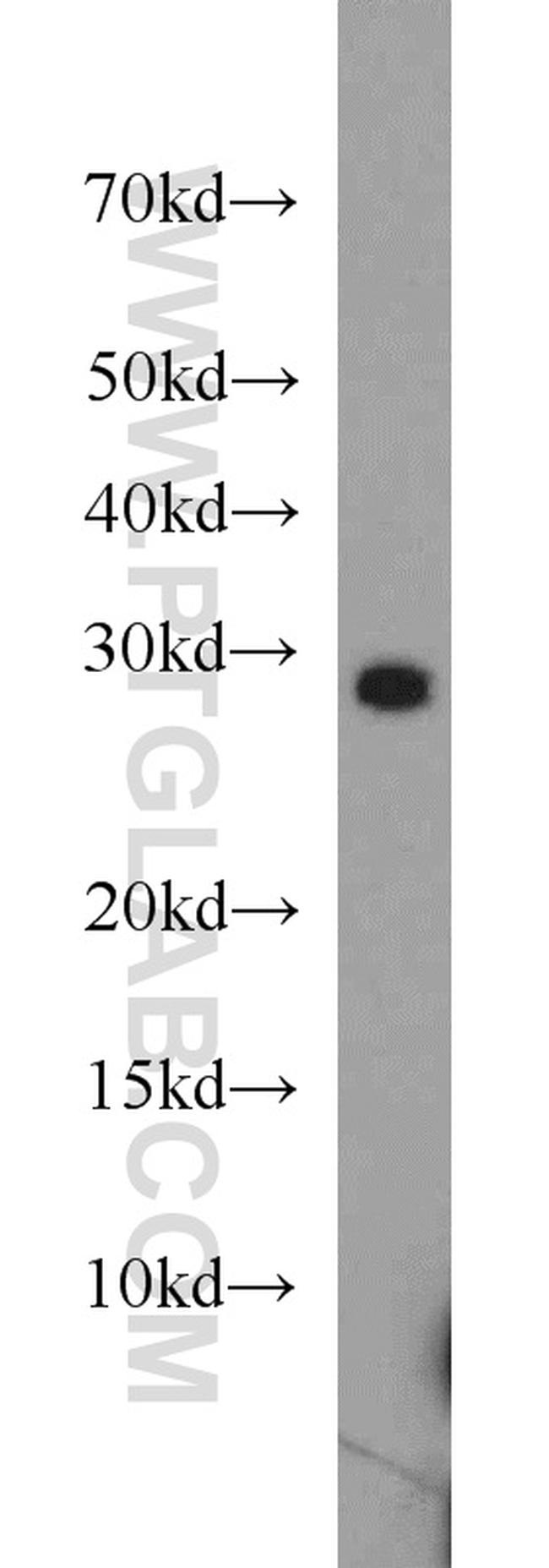 PPAPDC3 Antibody in Western Blot (WB)